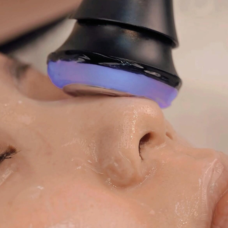 Skin Barrier Repair Facial — treatment goal