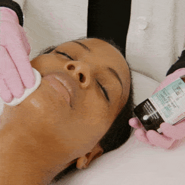 Chemical Peels