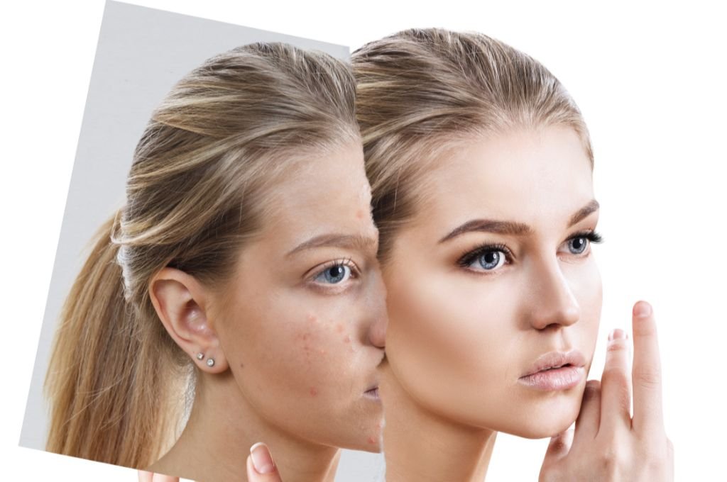 What We Aim to Improve with This Treatment