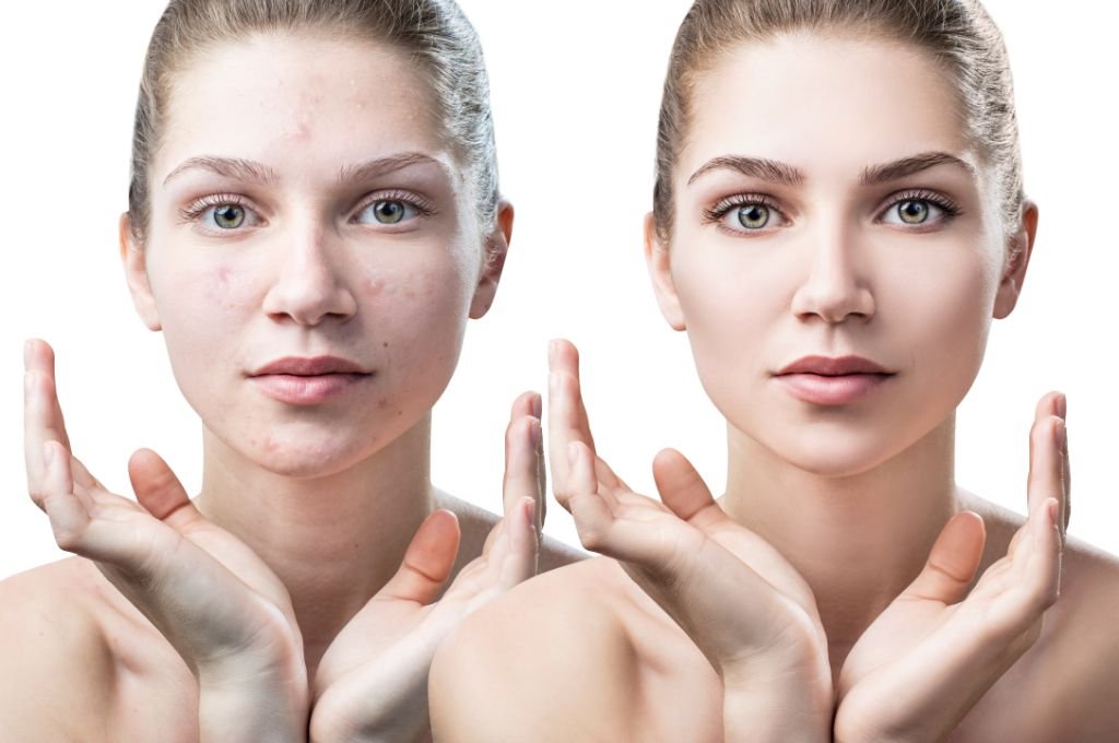 What We Aim to Improve with This Treatment