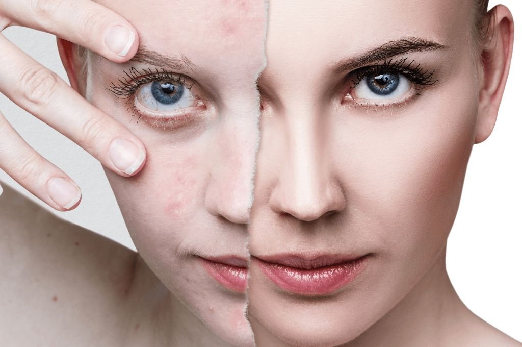 What Are the Symptoms of “Pre‑Event Dullness / Uneven Texture”?